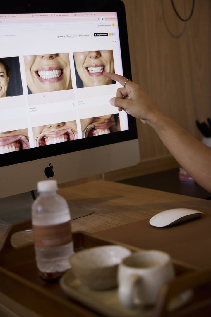 Planejamento e comparação clínica do sorriso no computador
