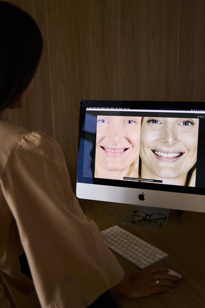 Planejamento facial e do sorriso no computador